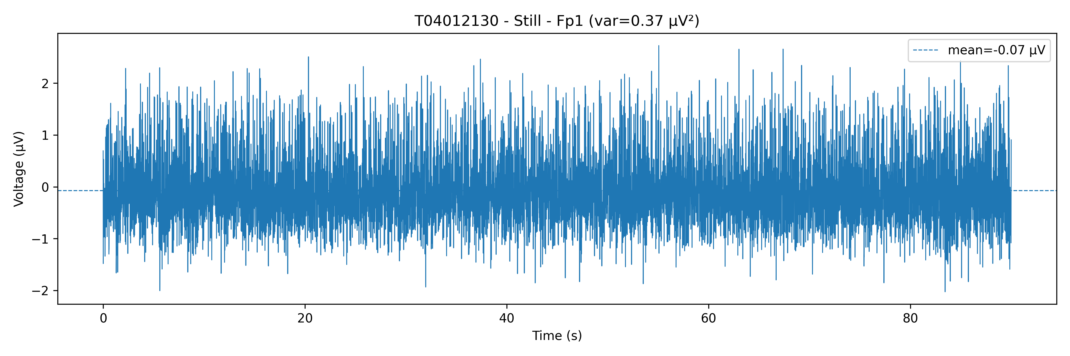 Time-Voltage EEG